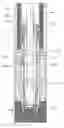 Fig. 01 - Mitigating drilling circulation loss