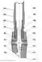 Fig. 01 - Method and system for creating unloading slots in oil and gas wells by stretch-slotting perforation