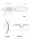 Fig. 03 - Gasket equipped with bead with different hardness