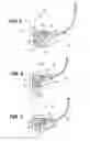 Fig. 04 - Threaded boss for pressure vessel