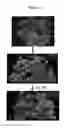 Fig. 02 - TREATMENT OF INFLAMMATORY DISEASES