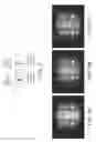 Fig. 09 - Optical assay device with pneumatic sample actuation
