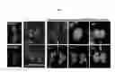 Fig. 06 - Phosphoinositide (4,5) Bisphosphate as a Diagnostic Tool and Target for Cancer Treatment