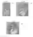 Fig. 04 - SHAPED ARTICLE