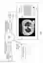 Fig. 11 - Chest x-ray differential diagnosis system