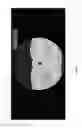 Fig. 13 - Chest x-ray differential diagnosis system