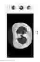 Fig. 15 - Chest x-ray differential diagnosis system