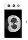Fig. 16 - Chest x-ray differential diagnosis system