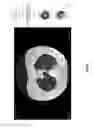 Fig. 17 - Chest x-ray differential diagnosis system