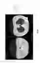 Fig. 18 - Chest x-ray differential diagnosis system