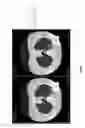 Fig. 19 - Chest x-ray differential diagnosis system