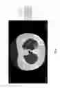 Fig. 20 - Chest x-ray differential diagnosis system