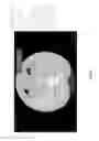 Fig. 22 - Chest x-ray differential diagnosis system
