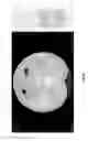 Fig. 23 - Chest x-ray differential diagnosis system