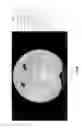 Fig. 24 - Chest x-ray differential diagnosis system