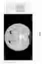 Fig. 25 - Chest x-ray differential diagnosis system