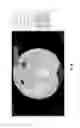 Fig. 26 - Chest x-ray differential diagnosis system
