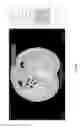 Fig. 27 - Chest x-ray differential diagnosis system