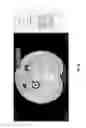 Fig. 28 - Chest x-ray differential diagnosis system