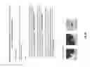 Fig. 29 - Chest x-ray differential diagnosis system