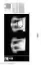 Fig. 34 - Chest x-ray differential diagnosis system