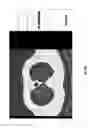 Fig. 41 - Chest x-ray differential diagnosis system