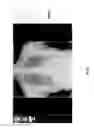 Fig. 43 - Chest x-ray differential diagnosis system