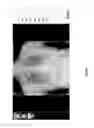 Fig. 44 - Chest x-ray differential diagnosis system