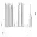 Fig. 60 - Chest x-ray differential diagnosis system