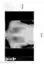 Fig. 43 - Medical scan report labeling system