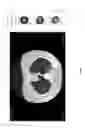 Fig. 16 - Medical scan diagnosing system