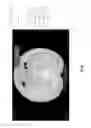 Fig. 22 - Medical scan diagnosing system