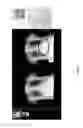 Fig. 34 - Medical scan diagnosing system