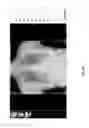 Fig. 44 - Medical scan diagnosing system