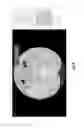 Fig. 26 - Medical scan interface feature evaluating system
