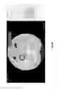 Fig. 28 - Medical scan interface feature evaluating system