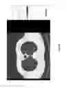 Fig. 41 - Medical scan interface feature evaluating system
