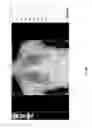 Fig. 44 - Medical scan interface feature evaluating system
