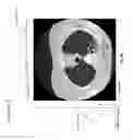 Fig. 54 - Medical scan interface feature evaluating system