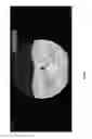 Fig. 13 - Medical scan comparison system