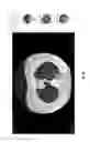 Fig. 15 - Medical scan comparison system