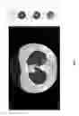 Fig. 16 - Medical scan comparison system