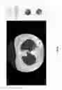 Fig. 17 - Medical scan comparison system