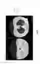 Fig. 18 - Medical scan comparison system
