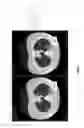 Fig. 19 - Medical scan comparison system