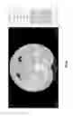 Fig. 23 - Medical scan comparison system