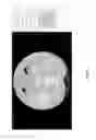 Fig. 25 - Medical scan comparison system