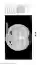 Fig. 26 - Medical scan comparison system