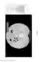 Fig. 27 - Medical scan comparison system