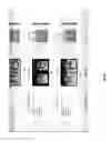 Fig. 33 - Medical scan comparison system